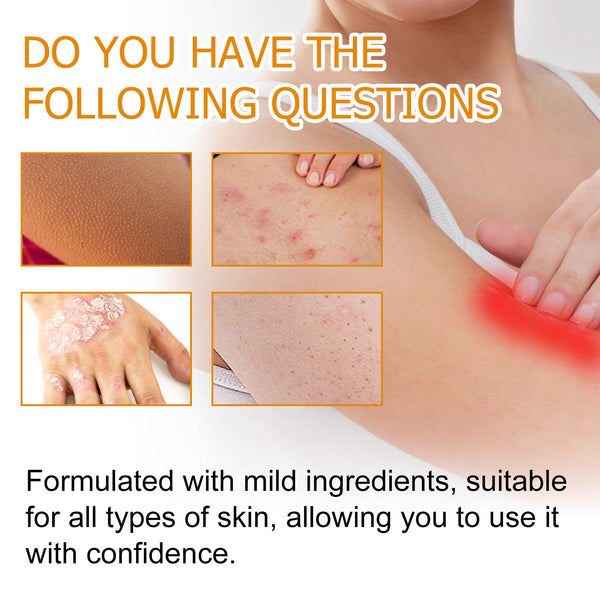 Relieve Itching And Redness Neck Cream